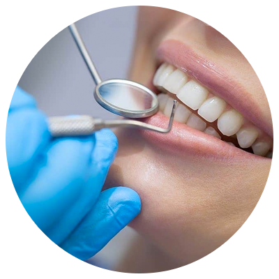Bonds | DM Arevalo Dental Clinic