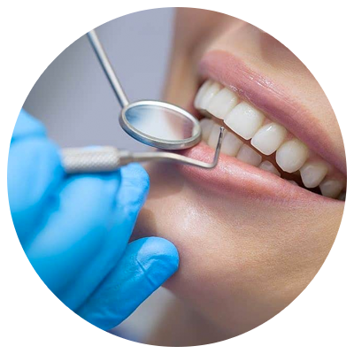 Bonds | DM Arevalo Dental Clinic Bonds | DM Arevalo Dental Clinic